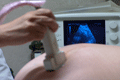 Clinic: IVF treatment