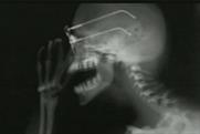 Tomorrow's Talent: Renault, x-rays