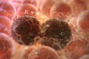 Cancer Research UK "one day" by Abbott Mead Vickers BBDO