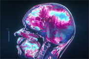 Alzheimer's Research UK "The smartest thing" by Wonderhood Studios