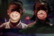 In Thailand, Operation Smile promotes cleft-lip surgery for kids