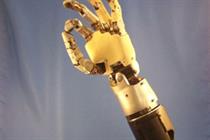 Prosthetics: what can we learn from scientific concepts?