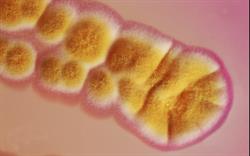 New antifungal, isavuconazole, licensed for severe infections