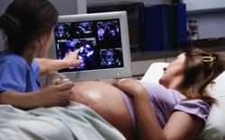 Pregnant woman having an ultrasound scan with a female sonographer