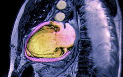NICE updates chronic heart failure guideline