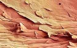 New non-oestrogen treatment for vaginal menopause symptoms