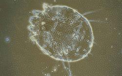 Microscope image of the scabies mite, Sarcoptes scabiei.