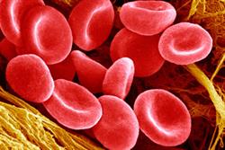 Exjade: first oral treatment for non-transfusion-dependent thalassaemia