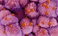 Antivirals for flu can now be prescribed on the NHS, DoH announces