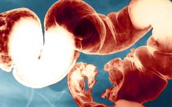 New oral combination chemotherapy for colorectal cancer
