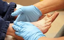 Foot care reminder for canagliflozin prescribing