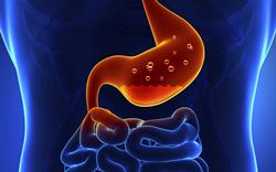 Proton pump inhibitors associated with low risk of cutaneous lupus