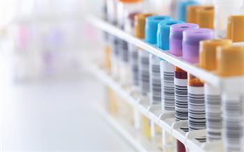 New MIMS table to guide antihypertensive monitoring in primary care