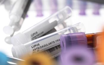 Prescribers advised not to use newer anticoagulants in patients with antiphospholipid syndrome