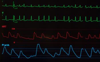 Updated NICE atrial fibrillation guidance recommends newer anticoagulants