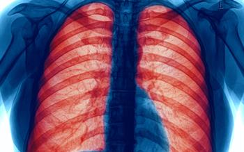 New biologic for severe eosinophilic asthma