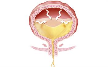 Reseachers advocate mirabegron for first-line treatment of OAB