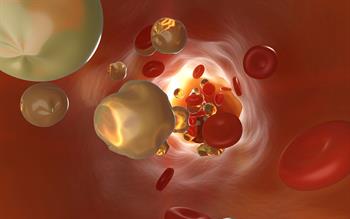 New lipid-lowering treatment available to prescribe