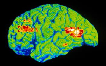 NICE recommends multimodal antidepressant for depressive episodes