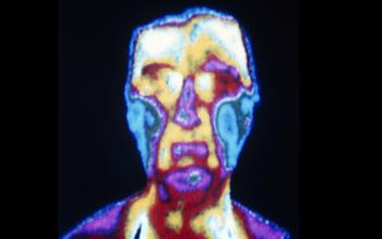 First in new class of migraine prophylactics launched