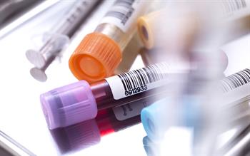 Purple, orange, blue and yellow blood test tubes on a tray.