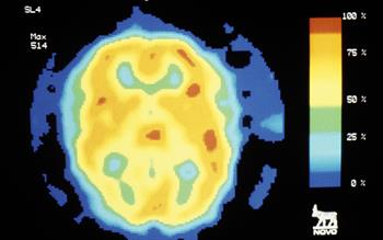 Further monthly injectable migraine prophylactic launched