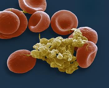 'No convincing alternative' to aspirin for secondary cardiovascular prevention, meta-analysis suggests