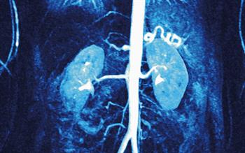 SGLT2 inhibitors 'seem preferable to DPP4 inhibitors' in diabetes patients at risk of renal events