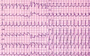 Cardiac warning for anticholinergic injection