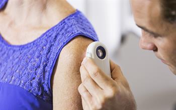 Advise patients of hydrochlorothiazide link to skin cancer, says MHRA
