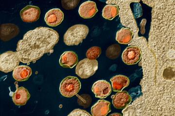 Clinical Review - Chlamydia
