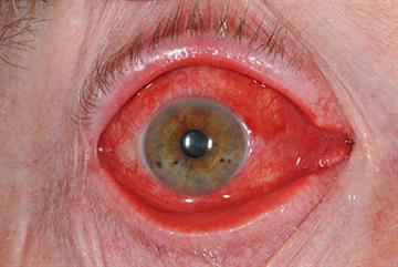 Eye disorders: illustrated