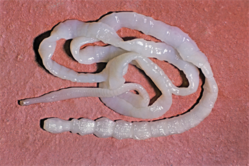 Tapeworm infestation in a returned traveller