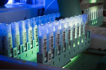 GPs could be incentivised to boost cancer screening uptake