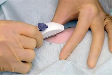Scrapped QOF indicator increased LARC uptake, study finds