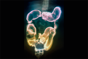Red flag symptoms: Vomiting in children, assessment and possible causes