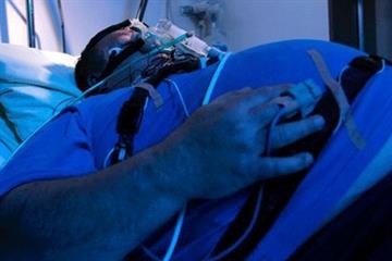 Clinical Review: Narcolepsy