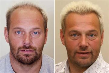 Diagnosis of common hair loss conditions