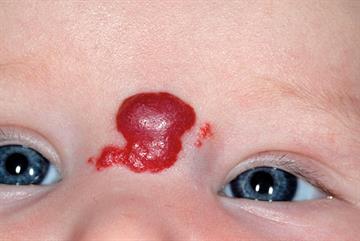 Paediatric problems: illustrated