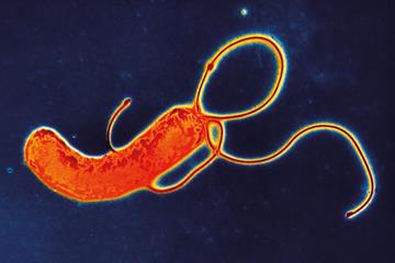 Dyspepsia - red flag symptoms