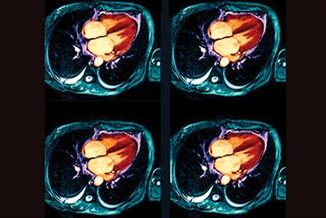 Clinical review: Valvular heart disease