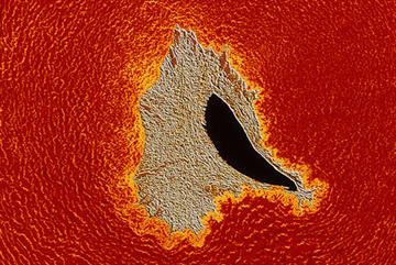 Clinical review: Peripheral vascular disease