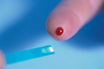 Viewpoint - Which is the best test for diagnosing diabetes?