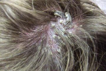 Dermatology: five pictorial cases and outcomes