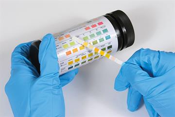 Immune drugs could help GPs treat antibiotic-resistant UTI
