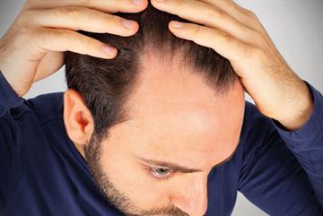 Alopecia, bariatric surgery and muscle relaxants for low back pain: journals update September 2016