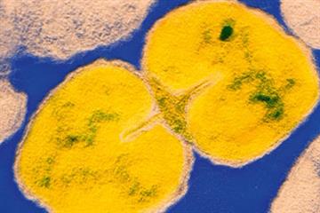 Antimicrobial resistant gonorrhoea
