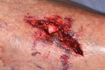 Trauma: Illustrated