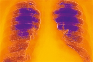 Clinical Review: Heart failure