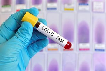 NICE backs new options to lower cholesterol when statins fall short